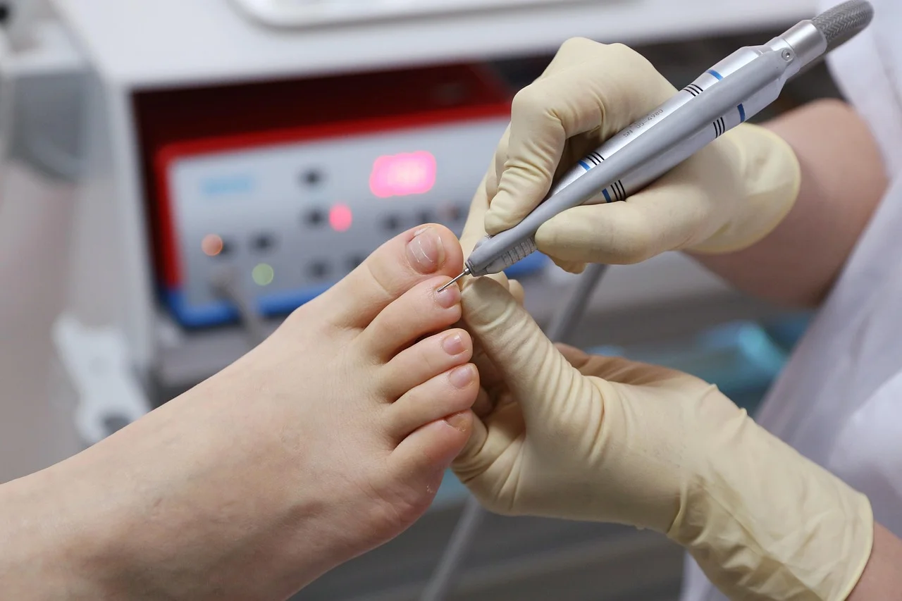 ¿Cómo cuidar los pies cuando aparecen las uñas encarnadas?